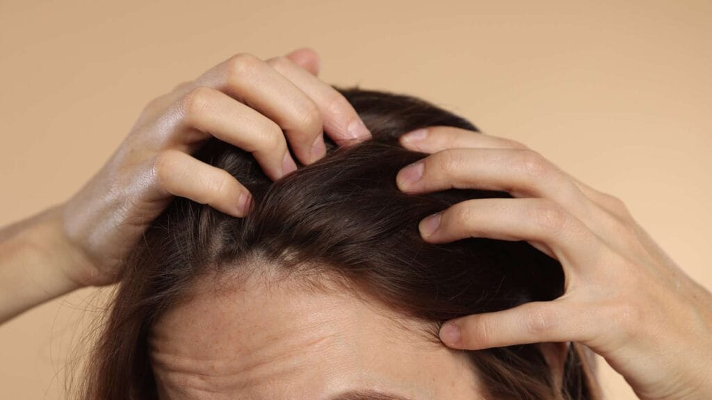 Hair Loss and Eating Disorders The Connection Explained